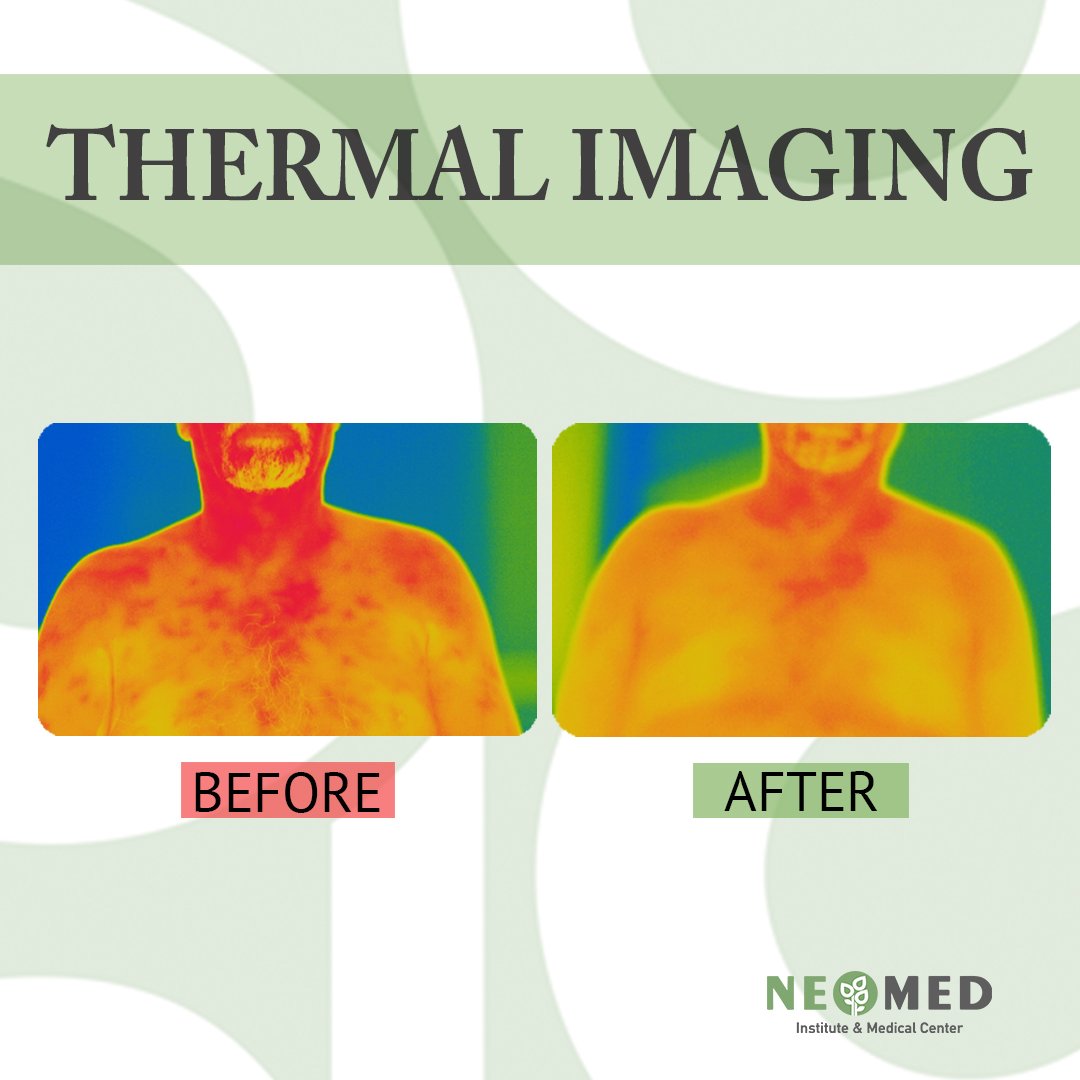 Thermal Imaging